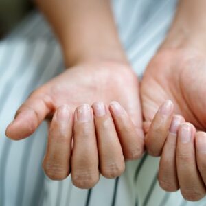 Why Are My Nails Peeling? 2 Experts Weigh In